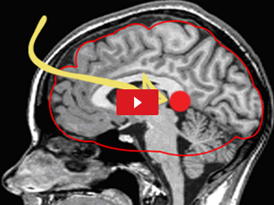 Is This “Fat Blaster” Brain Molecule The Key To Shocking Weight Loss? bit.ly/2Z7S3NX

#weightloss #weightloss #weightlosstips #weightlossjourney