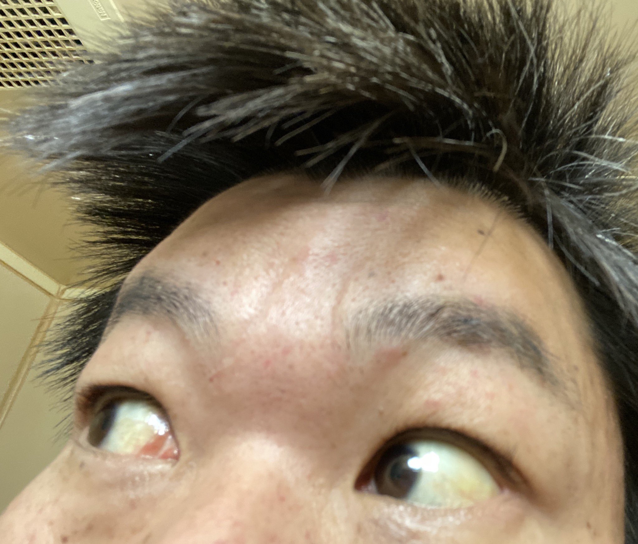 金バエ 禁酒1日目 Sur Twitter 目の黄疸は治ってきたような気がする ɷ 金バエ 禁酒1日目 Sur Twitter 目の黄疸は治ってきたような気がする ɷ
