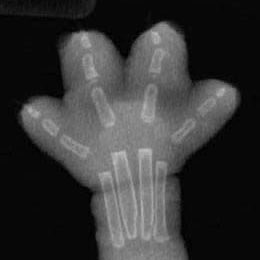 ฟิล์มเอ็กซเรย์ของมุอ้วง