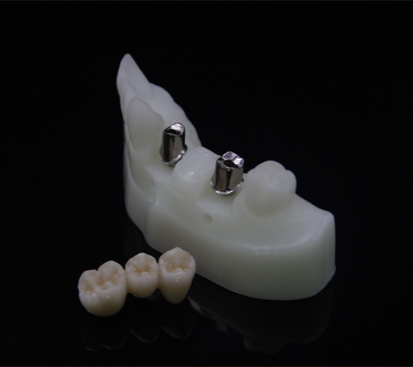 FullService_CDL's tweet photo. #Digital #dental #dentistry #crowns #clearaligners #allon4 #dds #zirconia #implant
Reducing shipping time, Saving-cost for you, just 48 hours after received files, Zirconia only 24 hours.
We have Professional team, Reliable quality, look forwards your inquiry. https://t.co/epxEk2w22T