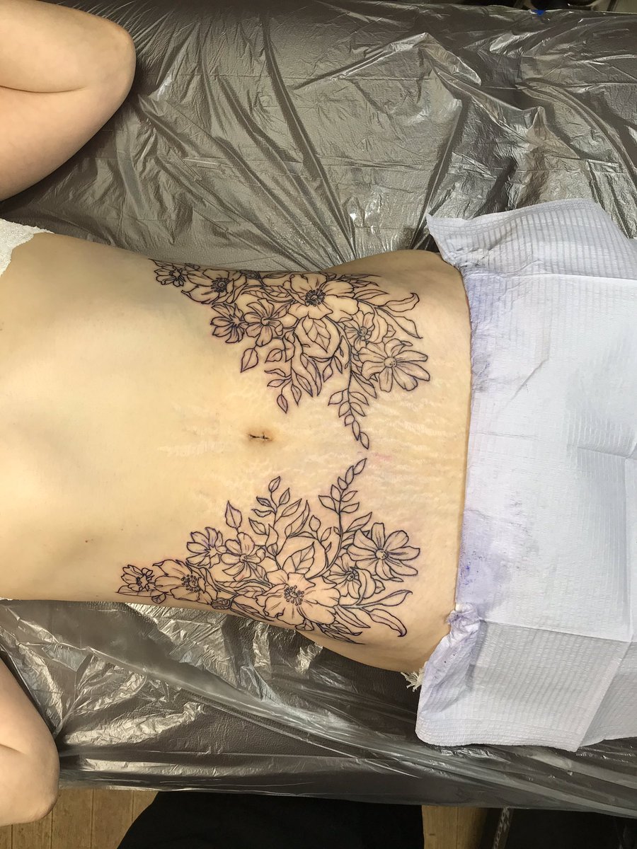 First session: Cover-up of stretch marks.#吉祥寺タトゥー