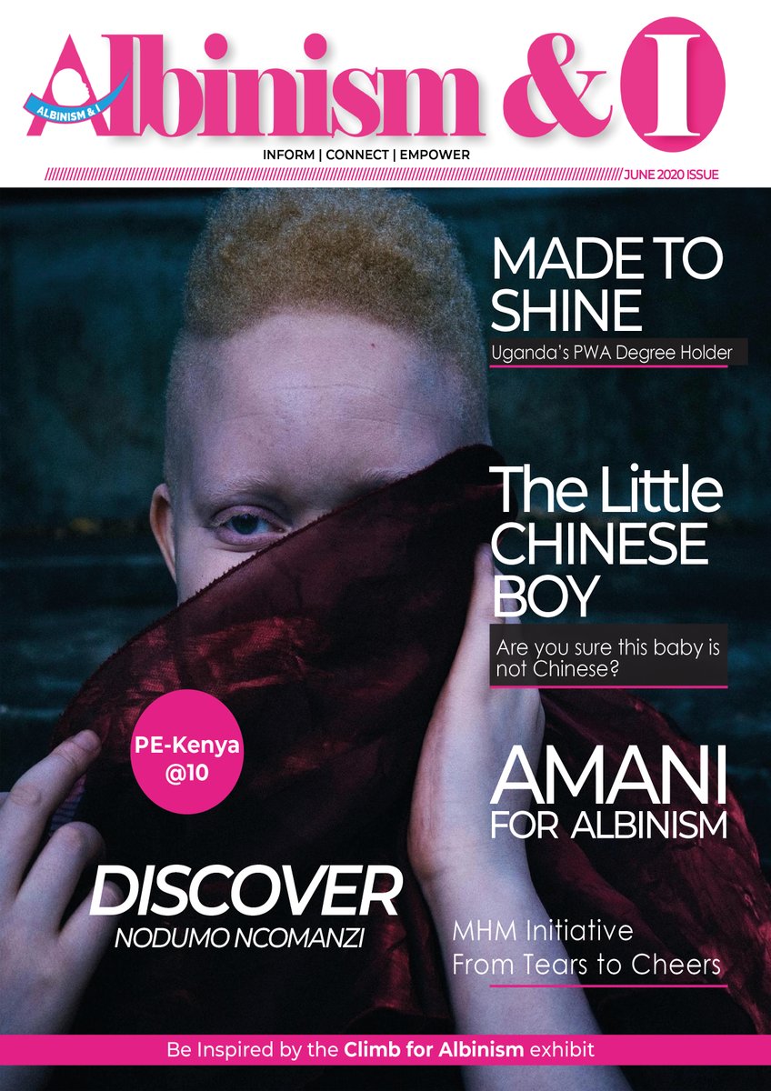 Soon we will provide instructions on how you will be able to download your own copy of the first ever ALBINISM &amp; I Magazine that changes the narrative of persons with albinism in Kenya and around the world.
#OwnYourStory #AlbinismIsHumanism #ChangingTheNarrative