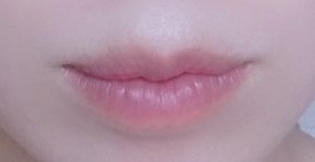 かめ 口唇縮小手術 Dt中 Ghqpqq3f6qqun Twitter