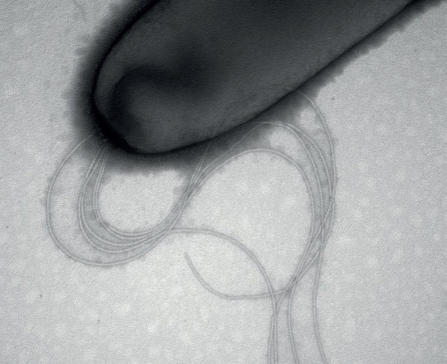 #GuessTheMicrobe non spore forming aerobic bacteria that have a flagellum for mobility. Some metabolise chemical pollutants in the environment &amp; are therefore used in bioremediation. Thanks <a href="/EU_ScienceHub/">Testing</a> and <a href="/theGSBI/">Soil Biodiversity</a>, picture by L. Howard #WorldMicrobiomeDay #DiversityMatters