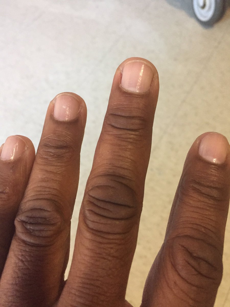 BuddhaBeatsEnt's tweet photo. Keep them nails done #WhatUpDoe https://t.co/q5Dge2eICE
