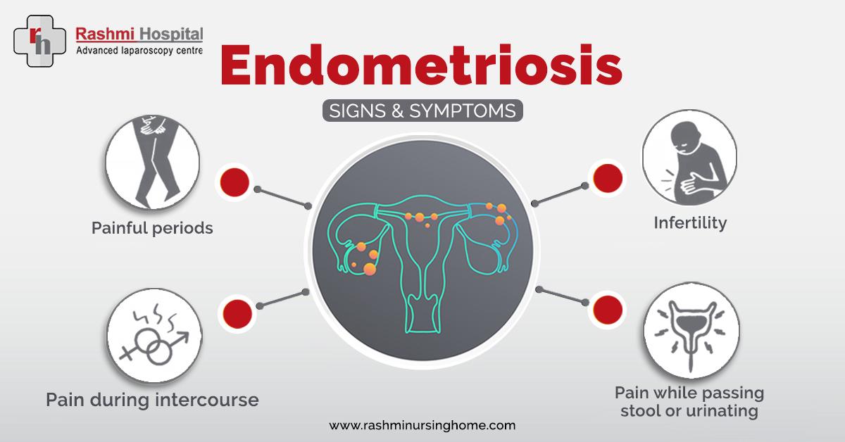 RashmiHospital's tweet photo. #ENDOMETRIOSIS #Rashmi_Hospital #Bangalore 

Visit us for gynecological issues: https://t.co/xZuX8zGSXr

Book appointment:  https://t.co/09en8phWZP

Feel free to message us for queries or doubts. https://t.co/xRfgVxKM4G