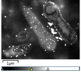#GuessTheMicrobe SEM of two strains bacterial strains capable to bioabsorb gold, making these bacteria a promising alternative in gold biomining  
Picture: TESCAN, Brno, Czech Republic,
#DiversityMatters #WorldMicrobiomeDay