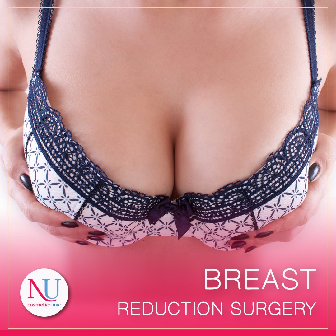 When is it time to get your breasts reduced?

if you have very large breasts, it can be somewhat of a nightmare for any woman due to the pain it can cause. 

These two are the most common complaints of females who meet with a #breastsurgeon 

Read more👉 buff.ly/31kr7xe