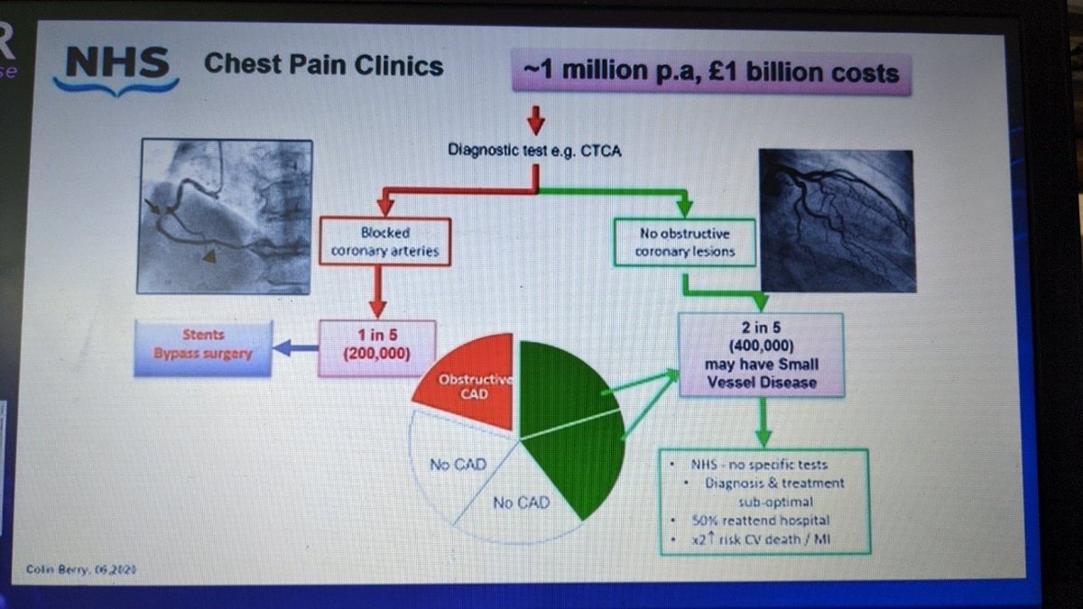 aayshacader's tweet photo. @ColinBerryMD #PCReCourse
#microvascular diagnosis in the #cathlab
💥NOT benign
💥Under-recognized, maybe more common than obstructibe CAD
💥 Cath Lab diagnostic tests w linked Rx improve symptoms+QOL
💥#CORMICA trial⤵️
@PCRonline @DavidLBrownMD @venkmurthy @alaide_chief https://t.co/Y3f66jfKPp