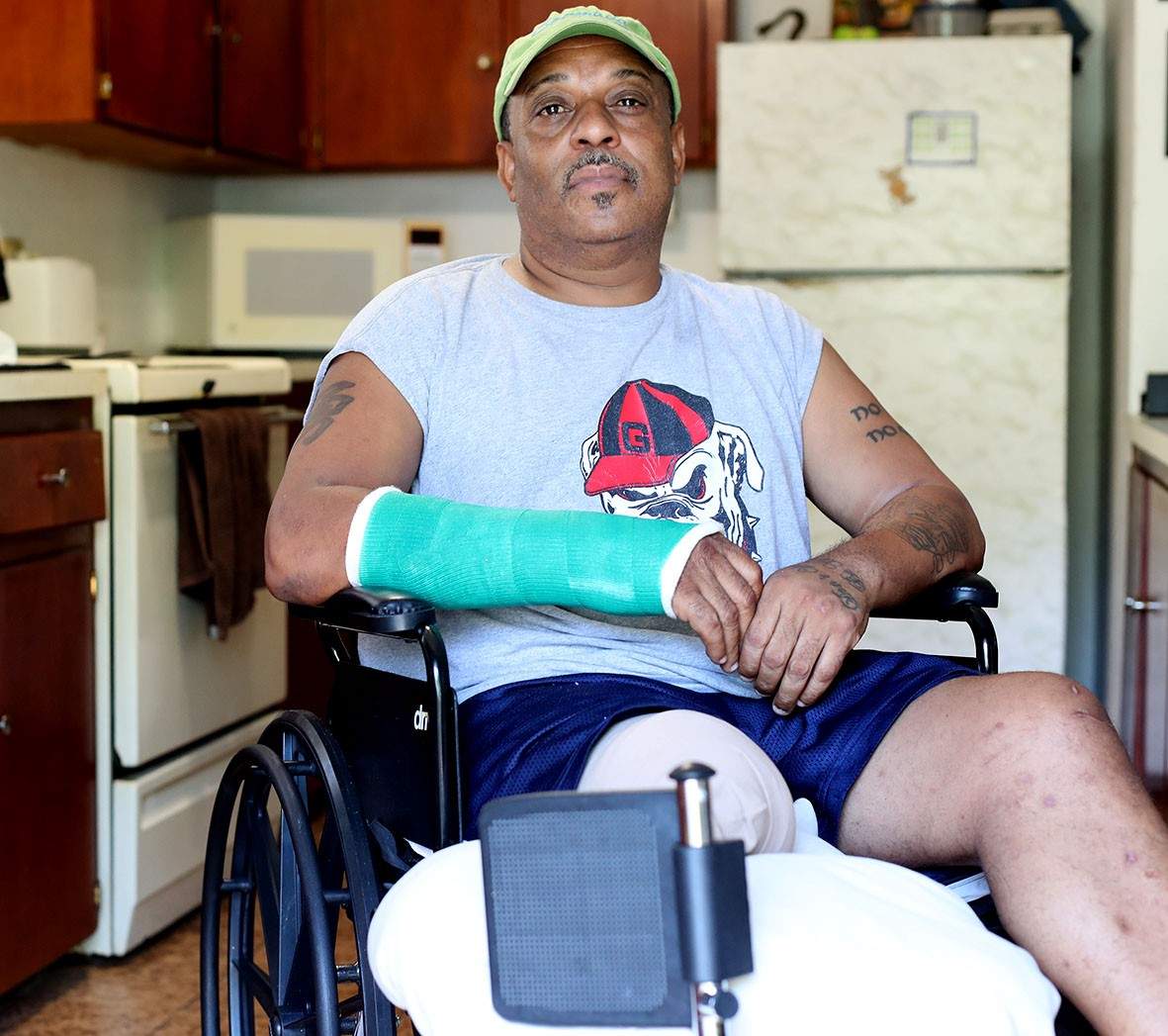 'Drink-driving cost me my leg' ow.ly/m3tP102hGO4 #DriveForChange #BermudaTraffic #Bermuda