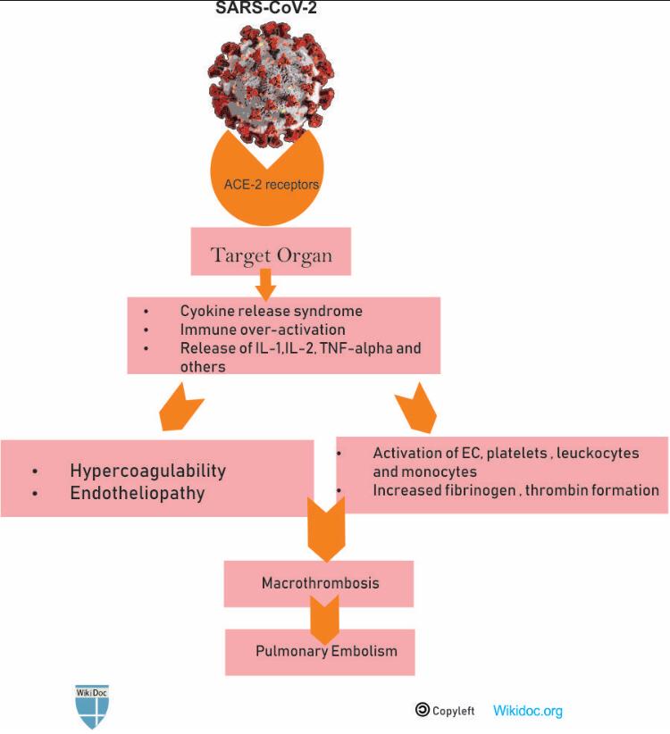 wikidoc's tweet photo. Pathophysiology of COVID-19 associated pulmonary embolism.
#COVID19
#pulmonology
#SARSCoV2
#WikiDoc
#medtwiter https://t.co/DyU9rwA8k6