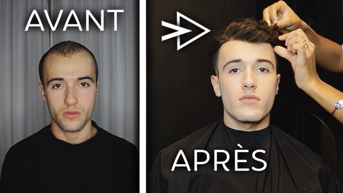 SimonVendeme's tweet photo. MA TRANSFORMATION CAPILLAIRE (Bye la perte de cheveux)

https://t.co/HlJIGs0fex https://t.co/oyh5jA9hPv