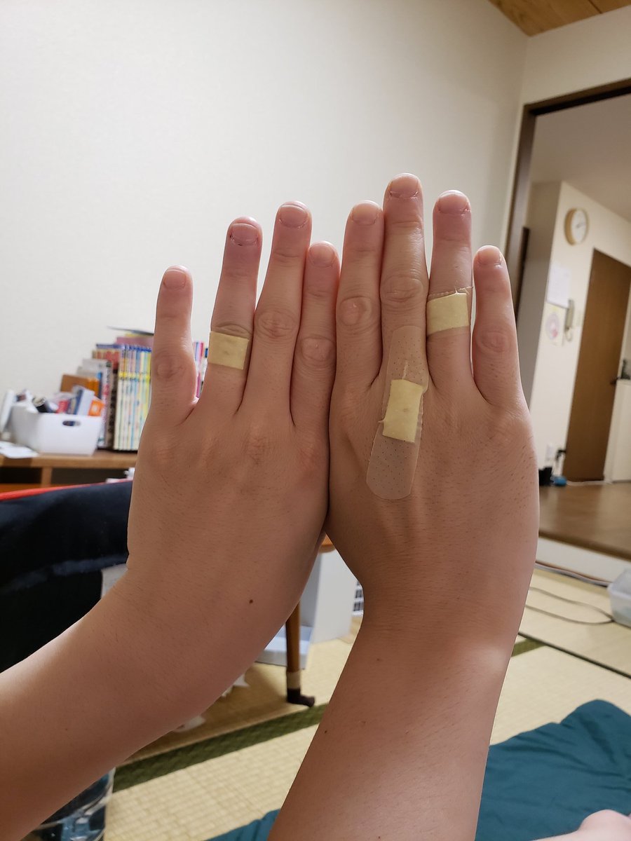 川田 洋一朗 指の毛が気になったから髭剃りで剃ったら血だらけになった 川田 洋一朗 指の毛が気になったから髭剃りで剃ったら血だらけになった