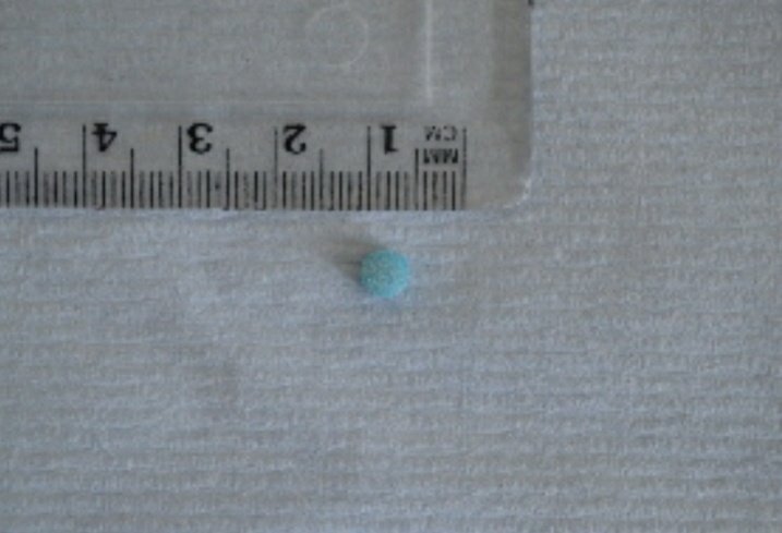 WithYouInKent's tweet image. KENT DRUG ALERT - Small, round, blue pills being sold as diazepam. May be marked &apos;10&apos; or &apos;DAN 5620&apos;. May contain flubromazolam. Danger of increased harms and side effects that may include psychotic states | Please circulate | Pic Credit @WEDINOSProject | #KENT #DRUG #DRUGALERT