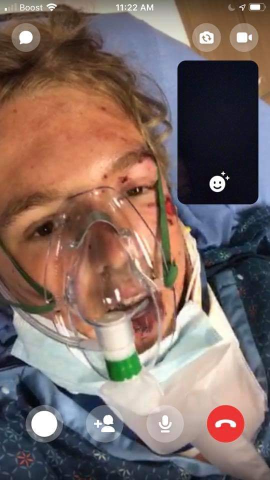 chewybaracka's tweet photo. This is my brother
Hit head on, and from behind 
Punctured lung, broken neck,ribs, collar bones, jaw, and occipital bone. His jaw is wired shut, he has a tube in his lung and he has a brace. He needs help squaring away this one towing bill, anything helps 
https://t.co/MHy3LbqfOv https://t.co/OBBc3Umsxu