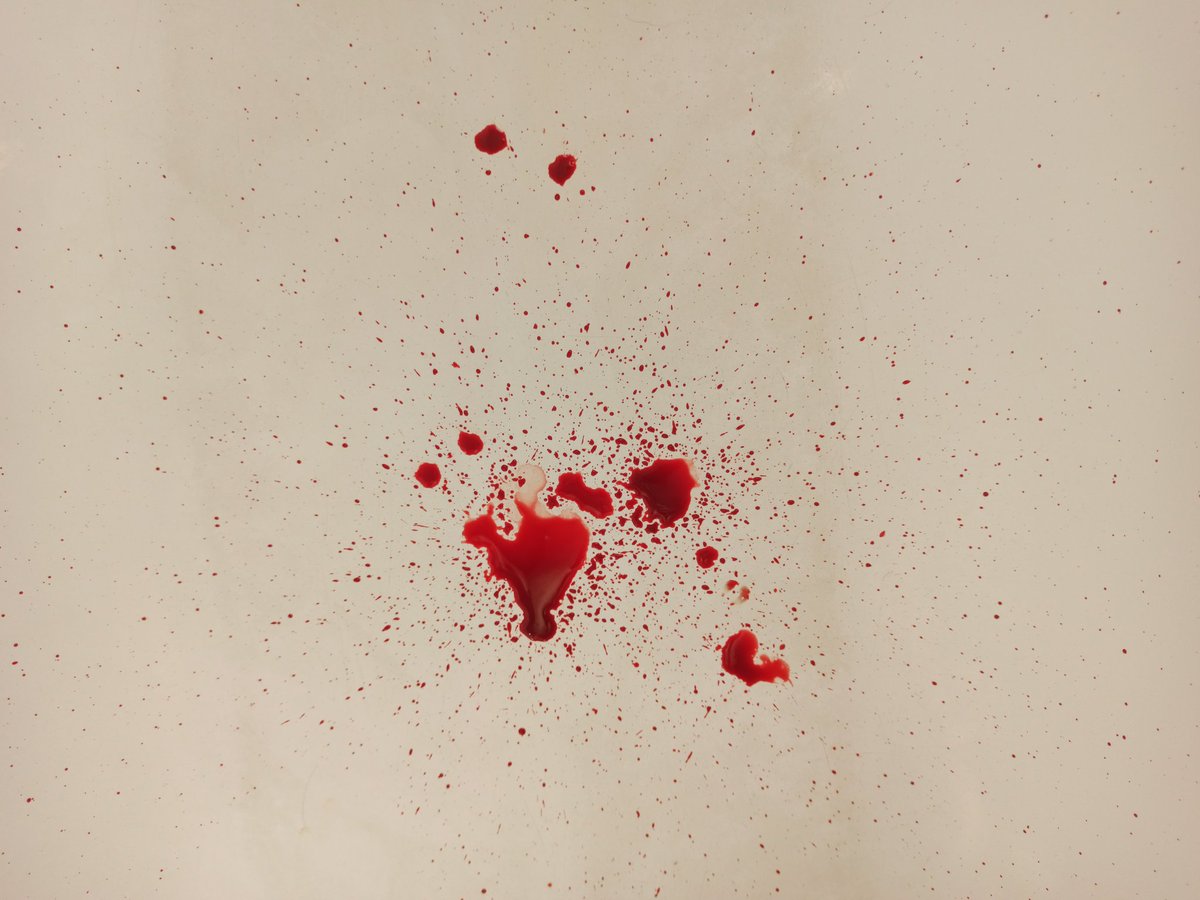RedMistress7's tweet photo. MY #slave is #bleeding and #suffering . 
#blood #SM https://t.co/Zzy31h9EJz