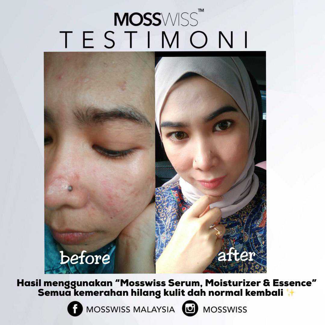 Banyak feedback kita terima dari customer yang dah try Mosswiss Skincare. Alhamdulillah we are so happy Mosswiss suite well with you  And mosswiss skincare ni SUITABLE FOR ALL SKINTYPE tau 