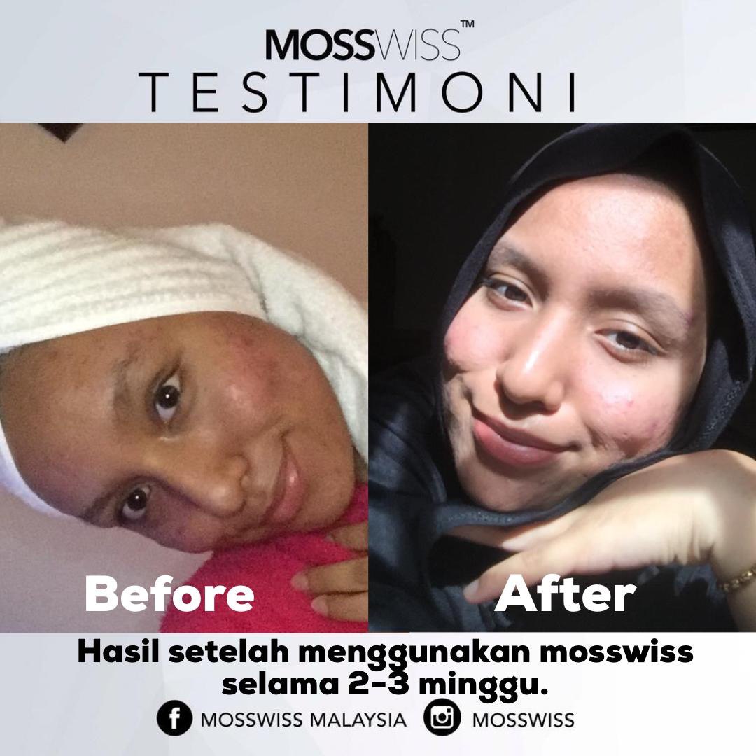 Banyak feedback kita terima dari customer yang dah try Mosswiss Skincare. Alhamdulillah we are so happy Mosswiss suite well with you  And mosswiss skincare ni SUITABLE FOR ALL SKINTYPE tau 