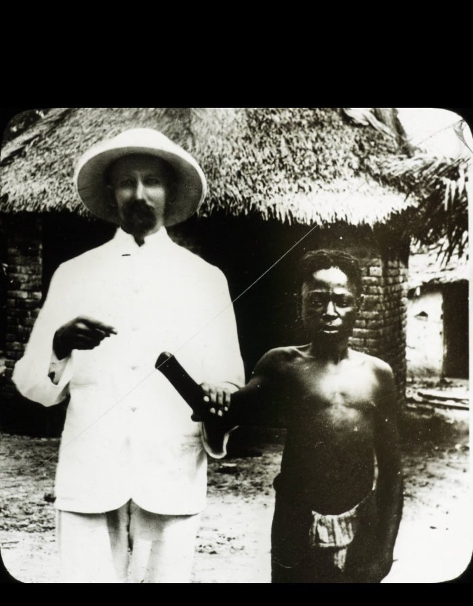 A child victim of Belgian atrocities in Congo stands with a missionary,