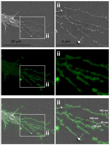 VUCellImaging's tweet photo. Great new paper from the Weaver Lab @AWeaverLab and @SungBH including lots of light and electron microscopy.  Check out this awesome correlative image!  Thanks for using and acknowledging the CISR! https://t.co/uy3uuhcEHX