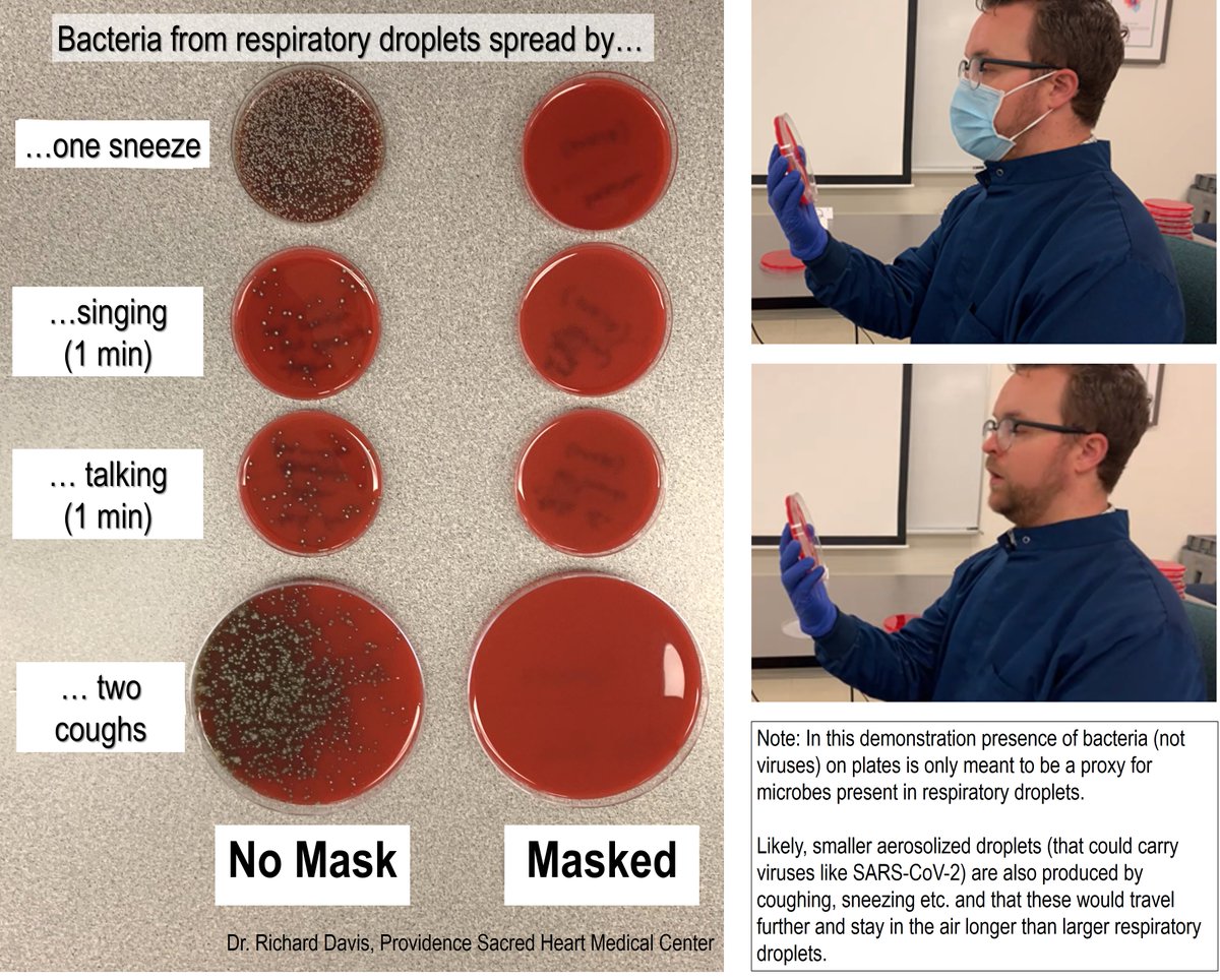 What does a mask do? Blocks respiratory droplets coming from your mouth and throat.Two simple demos:First, I sneezed, sang, talked & coughed toward an agar culture plate with or without a mask. Bacteria colonies show where droplets landed. A mask blocks virtually all of them.