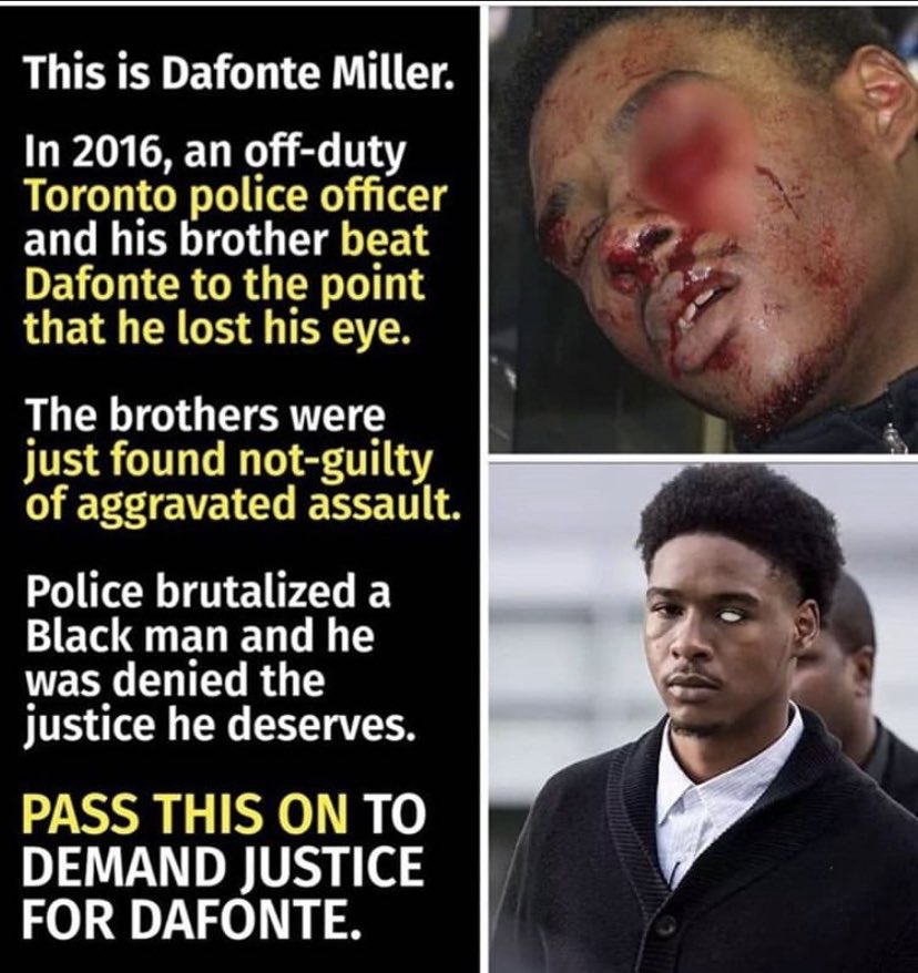 Gillyglamgirl's tweet image. This is what systemic racism looks like in CANADA people wake up #Defontemiller #BLM #DefundThePolice @CityNews @Faiza_AminTV @CP24 @CTVToronto @SteveRyanCP24 @TorontoPolice @YRP @PeelPolice @rcmpgrcpolice @globalnewsto @6ixbuzztv @thashaderoom @TheSocialCTV @flow935