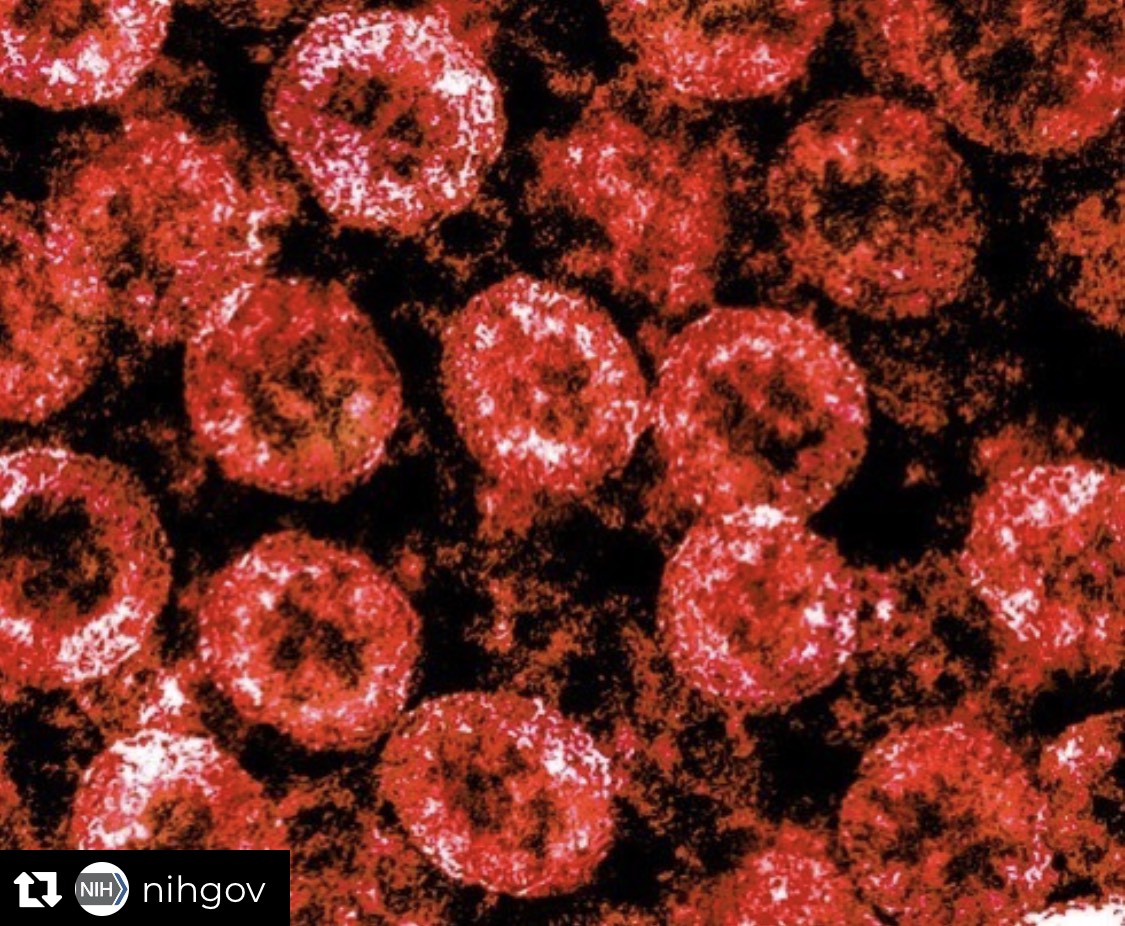 AscpChampions's tweet photo. Great post by @NIH discussing studies about why respiratory failure can occur in young and seemingly healthy people who have contracted #COVID19. Read their full post here https://t.co/DKmefceYiq #LabFactFridays https://t.co/cOGE8zzlO7