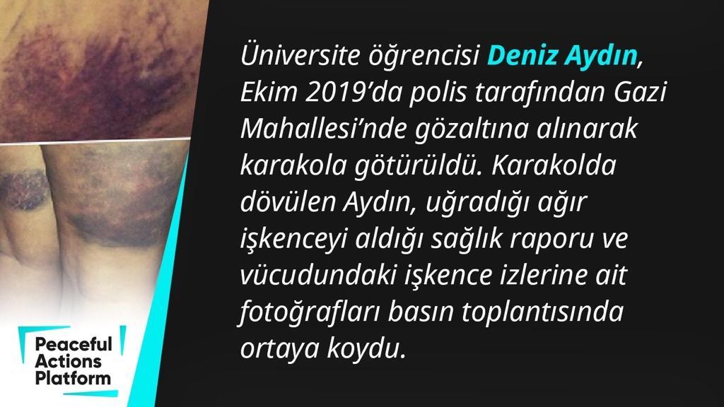 Deniz Aydın: Sadece bir genç.Polise silah doğrultmadı yada kötü söz bile söylemedi. Fakat Türk hükümeti kendisine muhalif olan herkesi düşman ilan etti. Şuan düşmana bile yapılmayacak muameleleri halkına yapıyor.
#TortureVictimsDay
#StopTortureInTurkey