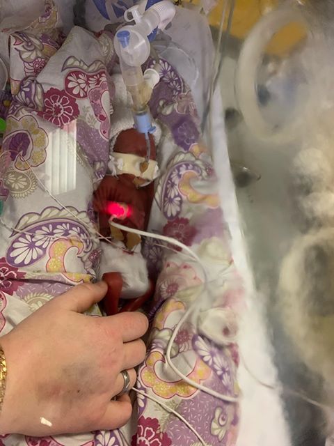 Blisscharity's tweet photo. "Ernie was born at 24+4 weighing 500 grams. He has had 14 blood transfusions, battled sepsis and a blood infection. As of last week he has passed his car seat and hearing test! He now weighs 5lb 5oz and we can’t wait for when they say we can take him home!!" #fridayfeeling https://t.co/zpPCHlWnm2