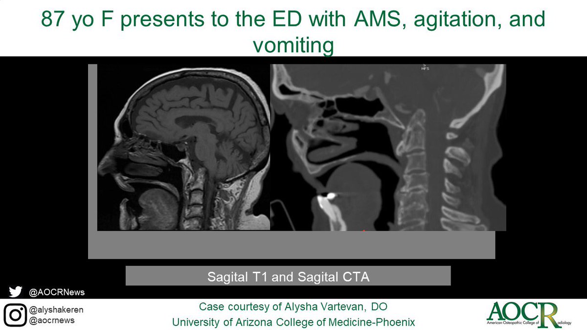 American Osteopathic College of Radiology tweet media