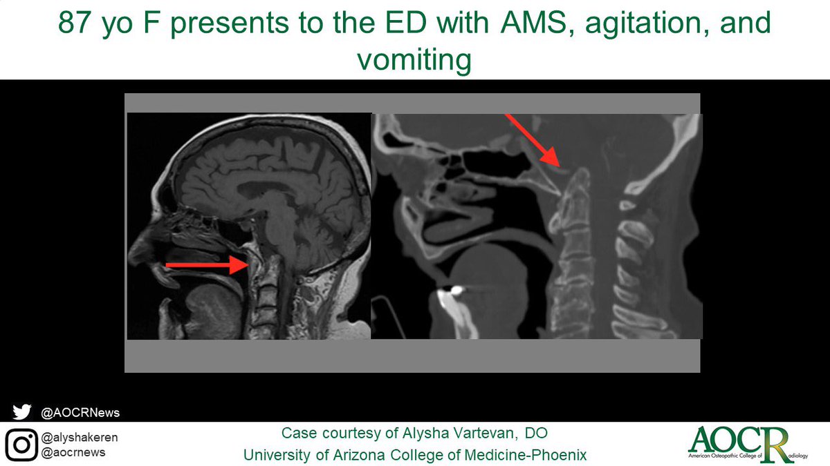American Osteopathic College of Radiology tweet media