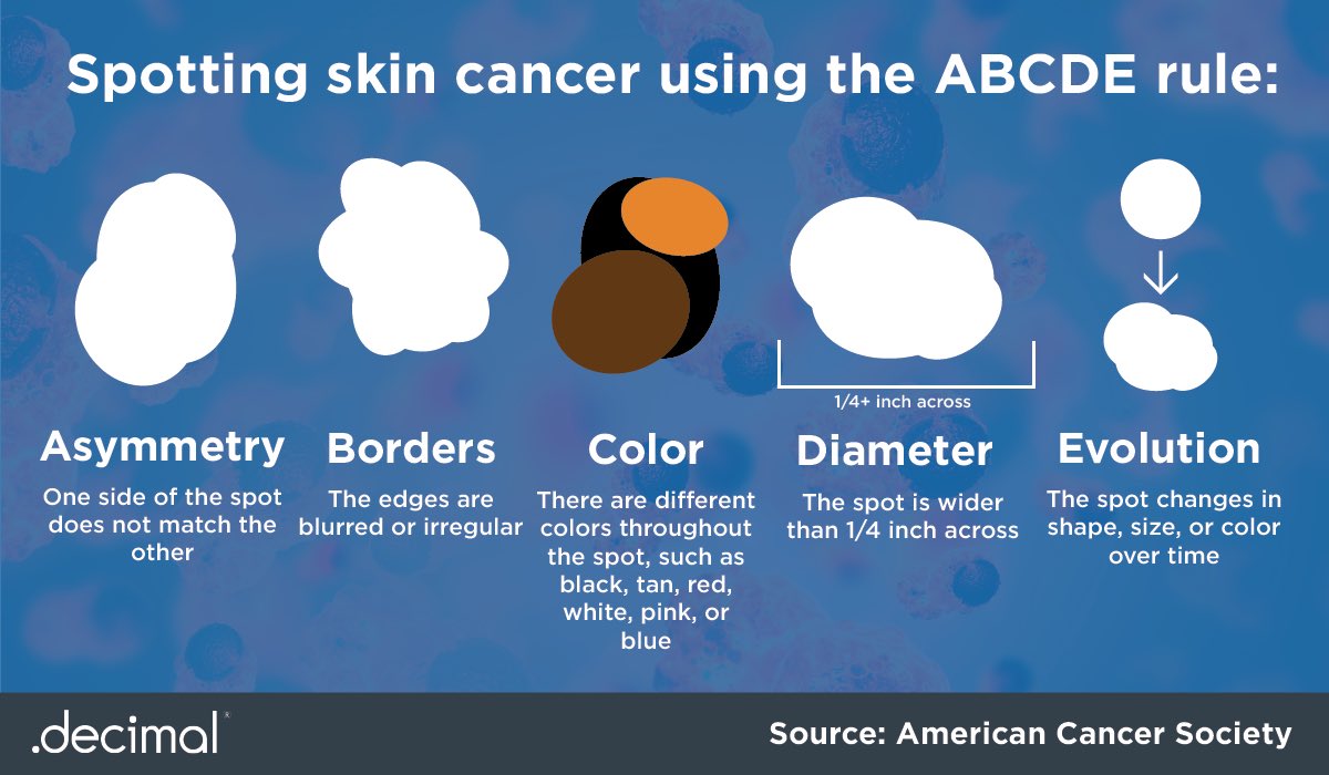 dotdecimal's tweet photo. .decimal hopes you're enjoying your summer. While out in the sun, make sure to limit your sun exposure using sunscreen and protective gear to lessen your chance of skin cancer. Check your moles regularly using the ABCDE rule! #dotdecimal #skincancerawareness https://t.co/d5qA04JtOW