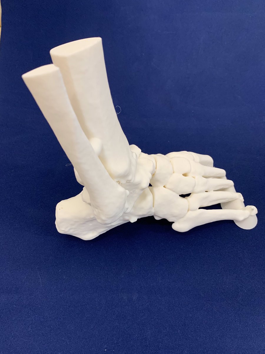 An osteotomy is when a bone is cut to change it’s size or alignment. 3D printing gives the advantage for the surgeon to perform a test cut before proceeding to surgery. A good plan is crucial for success!
 These models were printed on our <a href="/Raise3D/">Raise3D Technologies</a> E2 printer. #sus #lth #3dprint