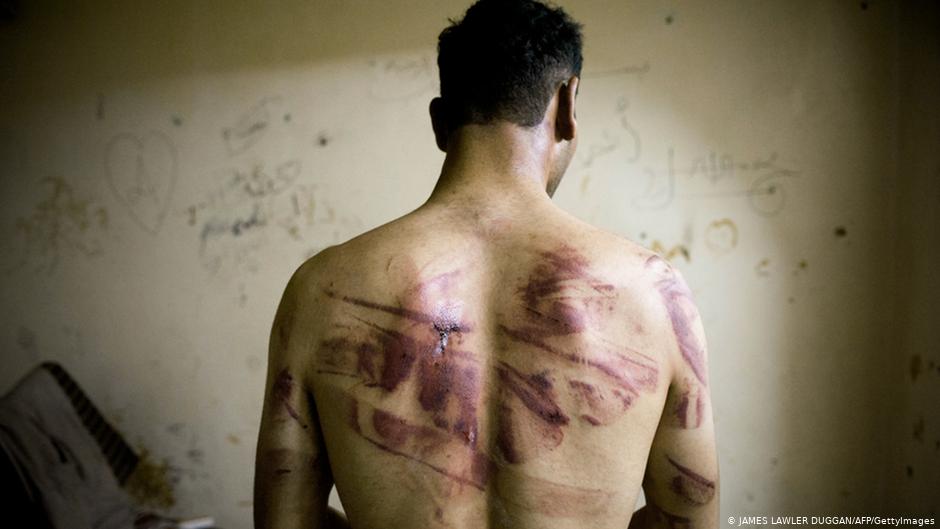 Nearly 14,388 Syrians have died by systematic torture in #Syria since March 2011, according to @snhr. #Caesar 's pictures convey a small portion of the horrors. On #TortureVictimsDay we demand legitimate accountability of these perpetrators, and justice for the victims' families.