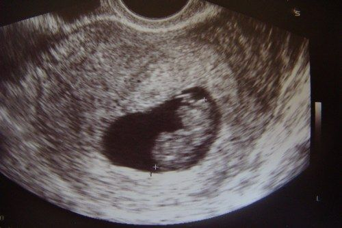 Los Derecho Humanos comienzan desde el vientre #ONUAbortoNo
 #ONUAllLivesMatter 

@UN@UNFPA@ONUMujeres@antonioguterres@mfespinosaEC@MelissaFleming@AminaJMohammed@ArgentinaUN@ColombiaONU@EcuadorONU@
MexOnu@PeruEnLaONU@SpainUN