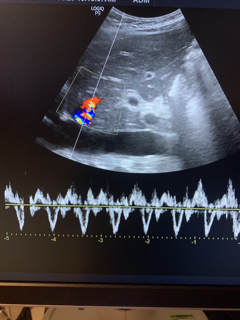 Jonathan J Suarez tweet media