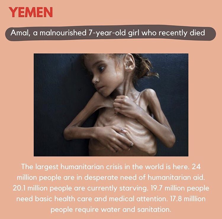 Yemen can’t wait!