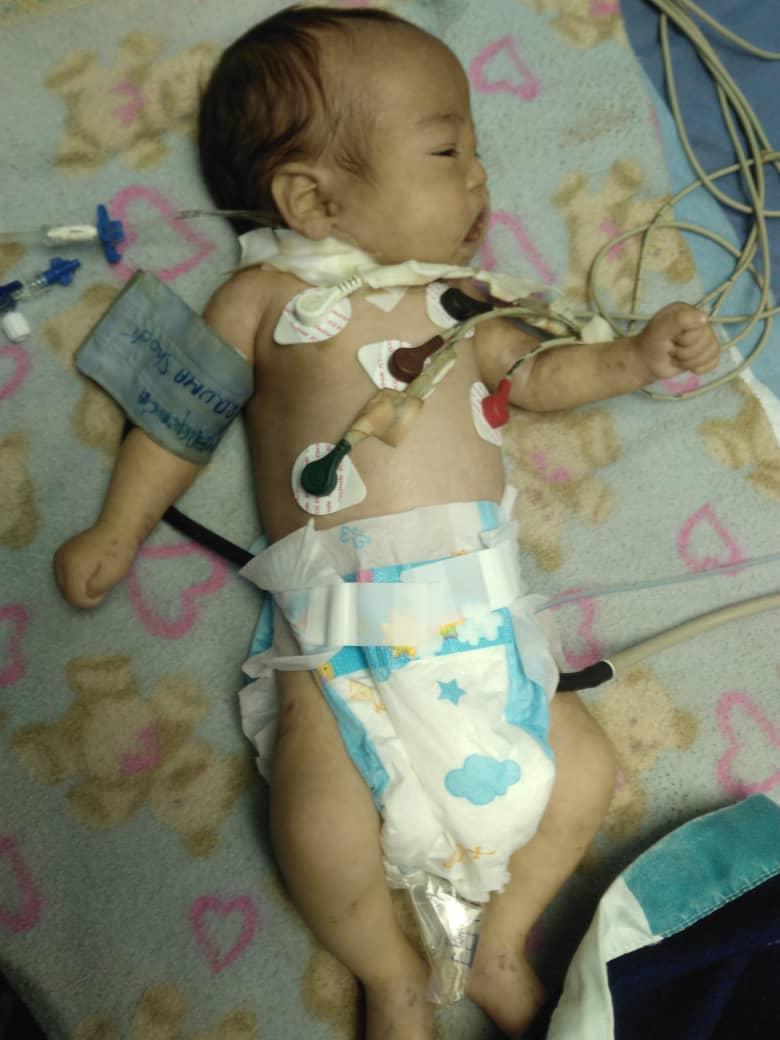 #ServicioPublico #URGENTE Para bebé de 2 meses Deremy jose Mireles. Tiene una Sepsis punto de partida le están poniendo albúmina transfusión de sangre está en trauma chok.

NECESITA: Albúmina. Pañales. Lividomin 6,5. Trazol

Contacto: Jose Mireles 
 04120362144
<a href="/shiabertoni/">Shia Bertoni</a>