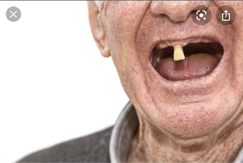 zoesiffmae's tweet photo. #allteethmatter https://t.co/DVQOUbdSYi