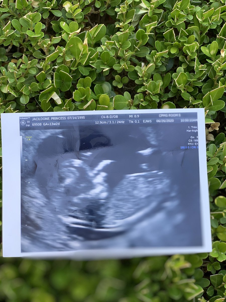 _xxpcj's tweet photo. Surprise!! Melody got promoted to big sister and we’re having a baby boy🥺💙 god blessed me with a sonshine! Baby number 2 is expected to make his debut 12/31/20 or 01/01/21 I AM SO BLESSED🤍 https://t.co/s5uErEDfKW