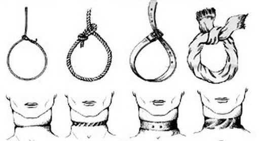 Петля в шее. Странгуляционная борозда схема. Странгуляционная асфиксия (повешение и сдавление шеи петлей). Механическая асфиксия странгуляционная борозда. Петли странгуляционная асфиксия
