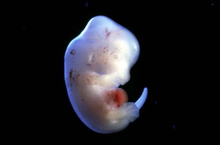 UlycesEditions's tweet image. Le Japon auto­rise la créa­tion d’em­bryons humains-animaux buff.ly/2SPpCRi