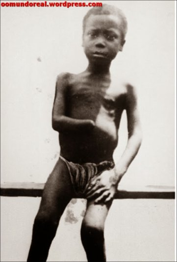 Leopoldo II de Bélgica colonizó el Congo de forma brutal. Su reinado en Congo se caracterizó por los asesinatos, torturas y atrocidades, como resultado de una notoria brutalidad sistemática. Las manos de hombres, mujeres y niños fueron amputadas cuando no se cumplía la cuota