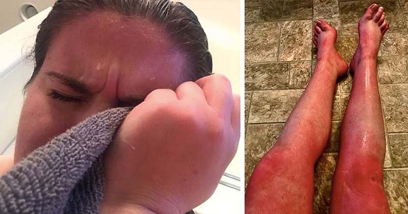 水アレルギー Twitter Search