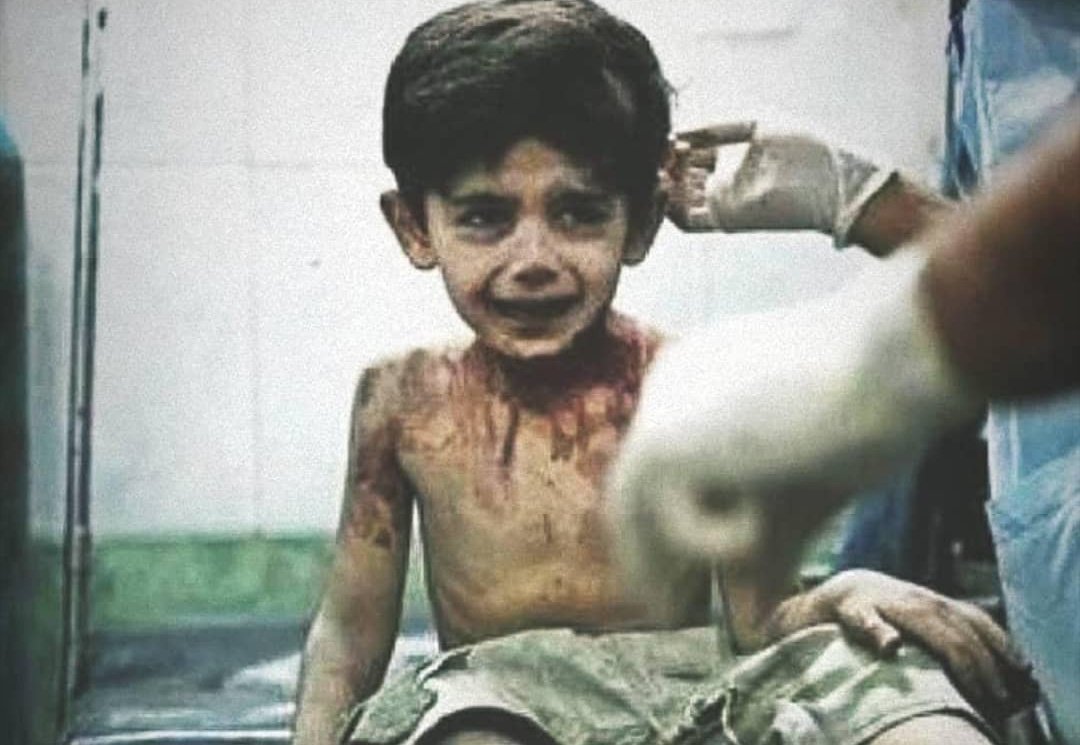 meetkhant's tweet photo. Remember! The last thing a 3-year-old Syrian kid said before he died, "I'm gonna tell God everything."
Looks like he did! 💔 https://t.co/9wPdSk19BF