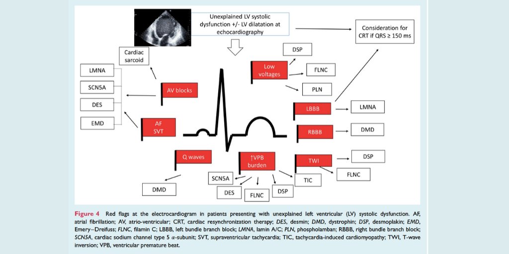gonzaeperez's tweet image. #ECGfirst en el diagnóstico y manejo de miocardiopatía dilatada
Revision @ESC_Journals 🆓
onlinelibrary.wiley.com/doi/full/10.10…