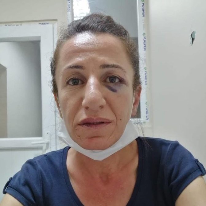 Demokratik Yerel Yönetimler Kurulu Üyemiz ve TJA aktivisti Sevil Rojbin Çetin, köpeklerle evini basan polisler tarafından işkenceye maruz kaldı. Kadına yönelik şiddetle mücadele ettiğini iddia eden iktidar, bu fotoğrafa iyi baksın!