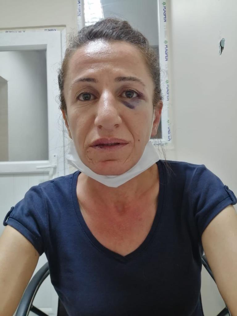 26 Haziran BM işkence ile Mücadele gününü 26 Haziran'da işkenceyle kutlamışlar..! 

Yerel Yönetimler Kurulu üyemiz, Van Edremit Belediye eş Başkanlığı yapmış Rojbin Çetin’e evde köpekler eşliğinde 3.5 saat işkence yapıldı. Ve hala gözaltında...