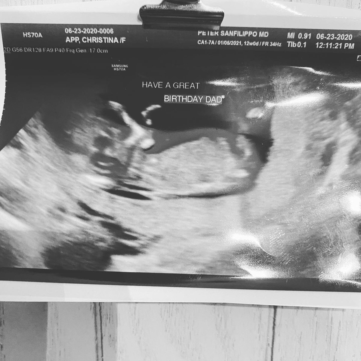 3 months ago, we got the best news of our lives. Over our birthdays, we were able to tell our families. Life couldn’t be better right now. I can’t to watch my wife be a mom and for myself to be a ZADDY