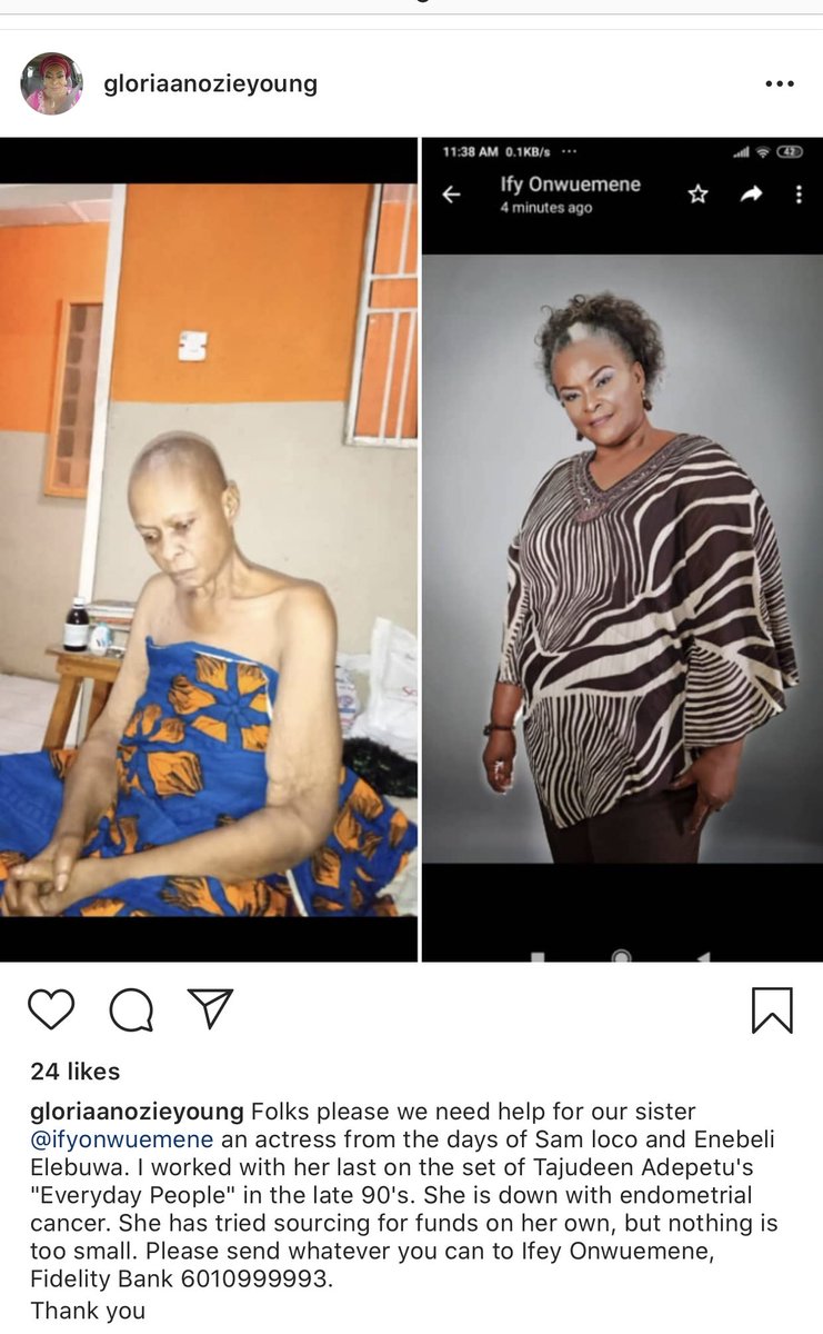 ELSiEiSY's tweet photo. If you watched Nollywood movies then you probably know IFY ONWUEMENE. She needs our help. Nothing is too small 🙏🏼  she is down with endometrial cancer. She needs help. 

Kindly send what you can to;
6010999993
Ifey Onwuemene 
Fidelity bank 

Please RT and help save her 🙏🏼🙏🏼 https://t.co/wp3zIuG1WZ